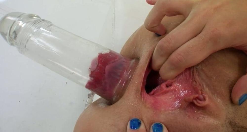 25P The Prolapse Holes #5 Mix - CoViD-88