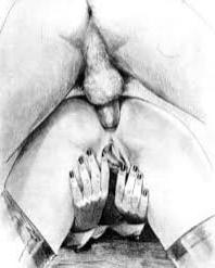 25P Art sex