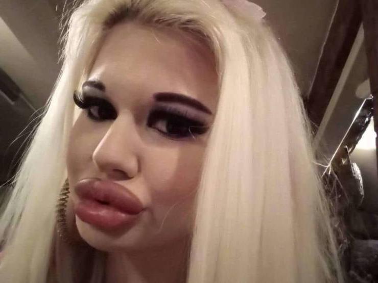 25P Girls 183