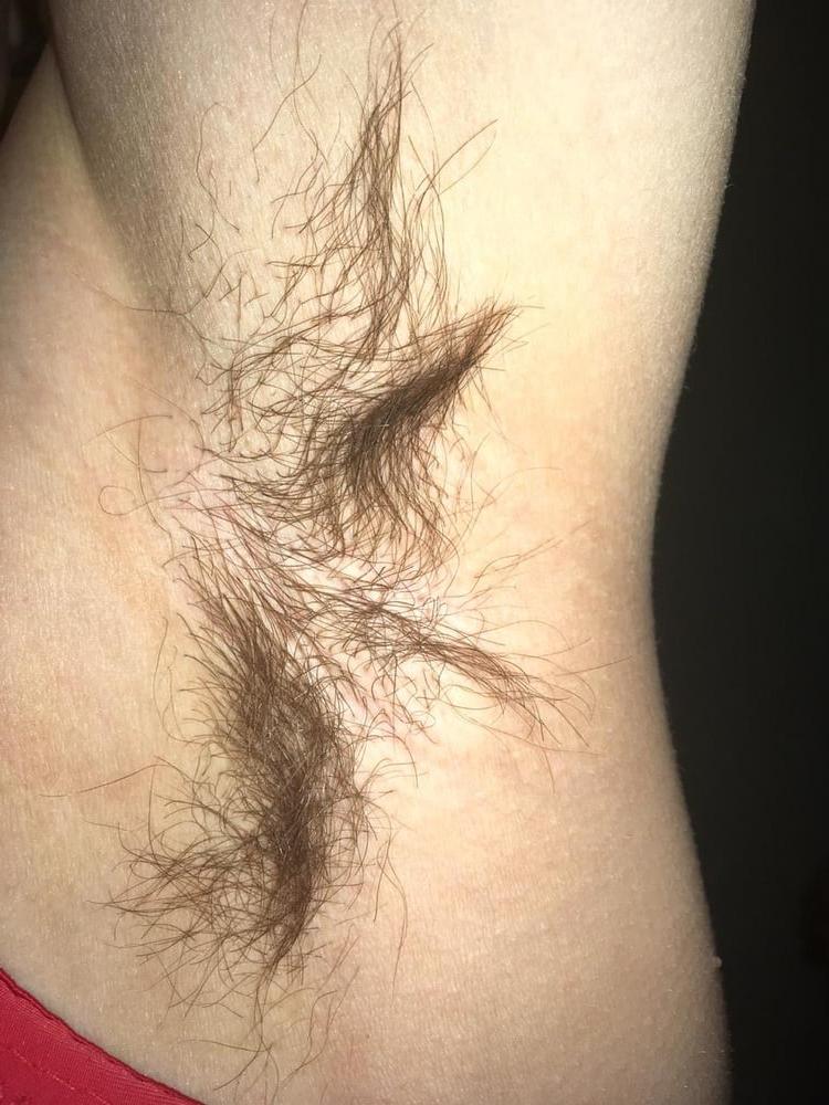5P armpit