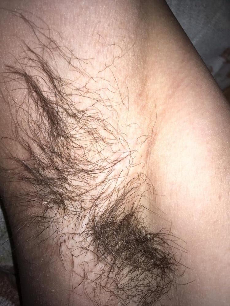 5P armpit