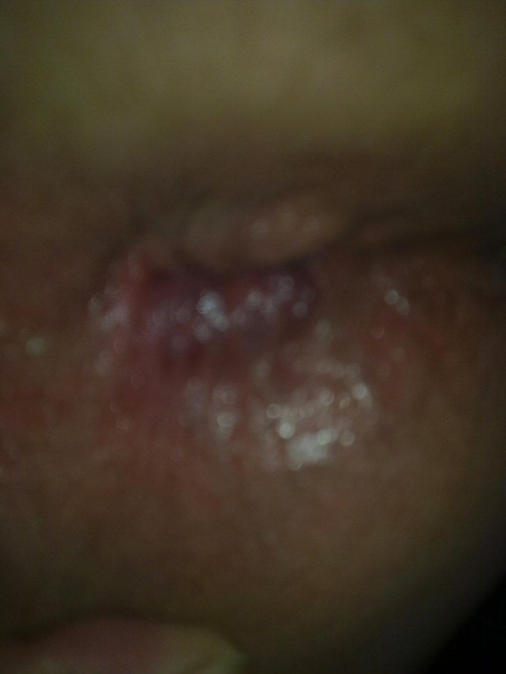 21P anal play