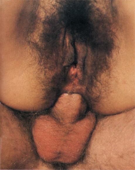 25P Nice Hairy Girls