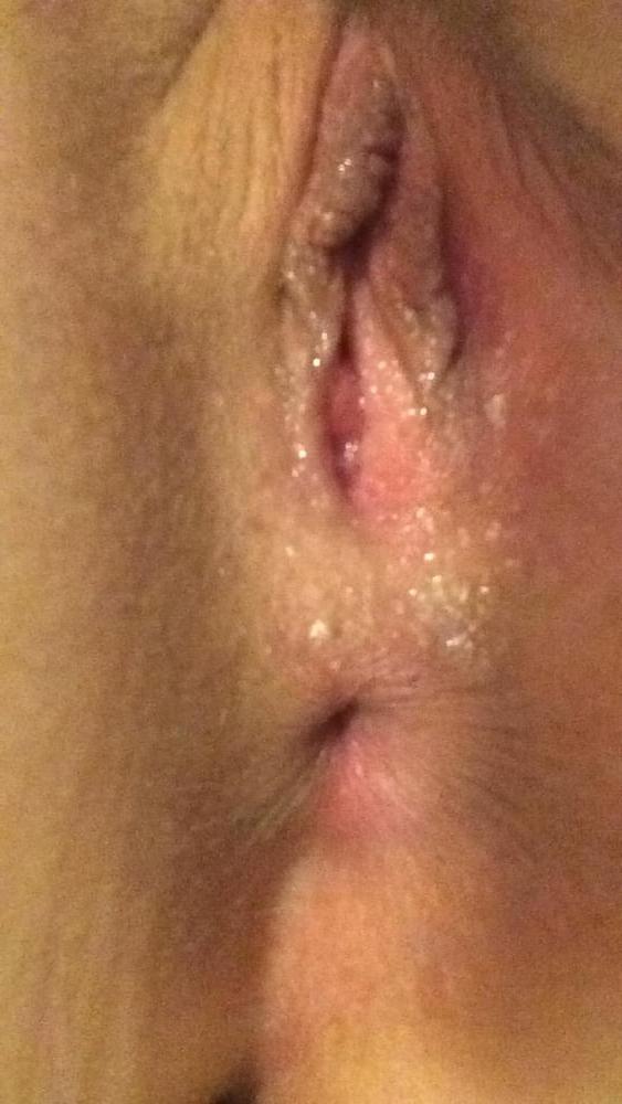 13P MY body