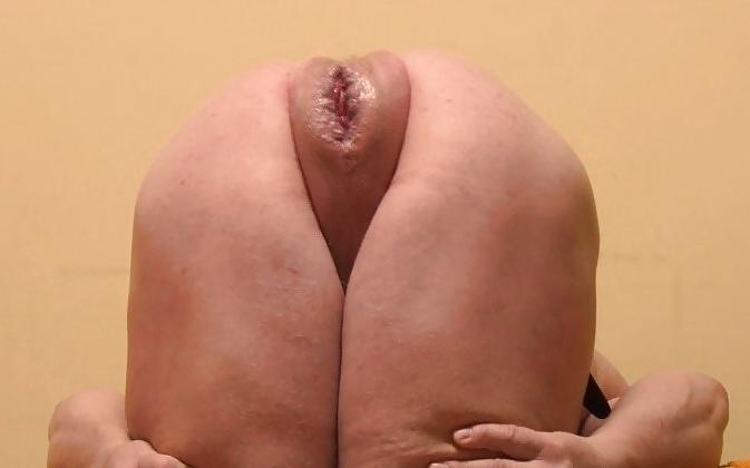 5P Bizarre insertion