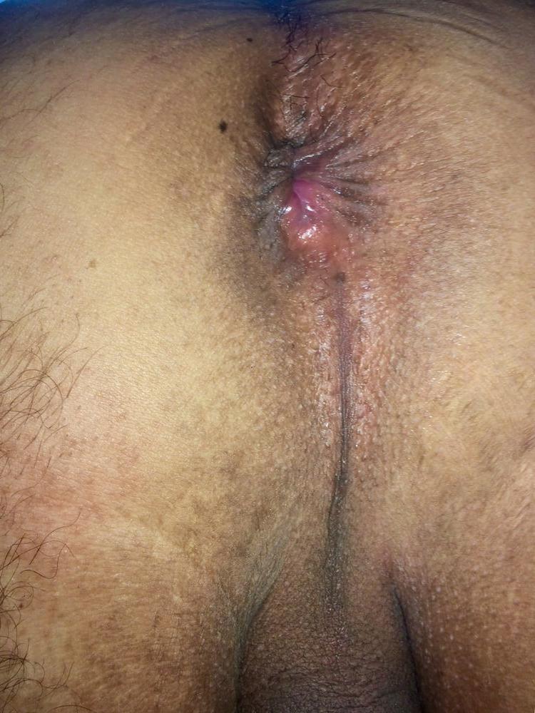 9P My ass