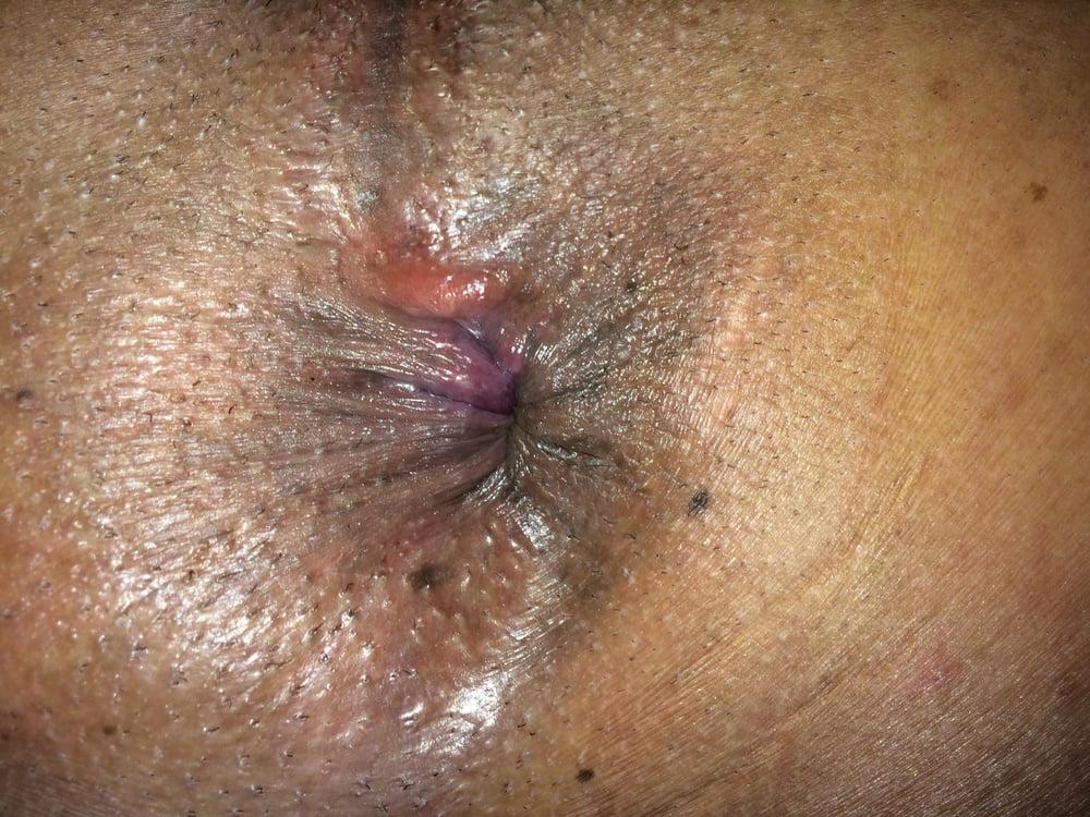9P My ass