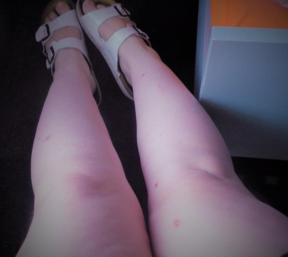 25P Sexy &amp; Chubby Legs 11