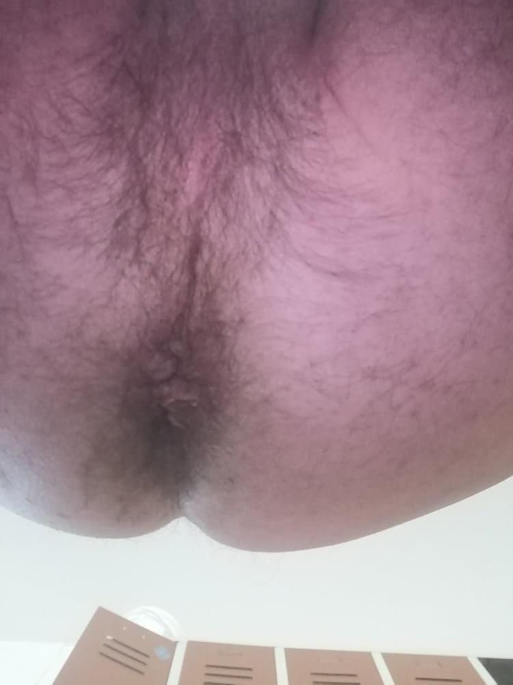 6P Ich