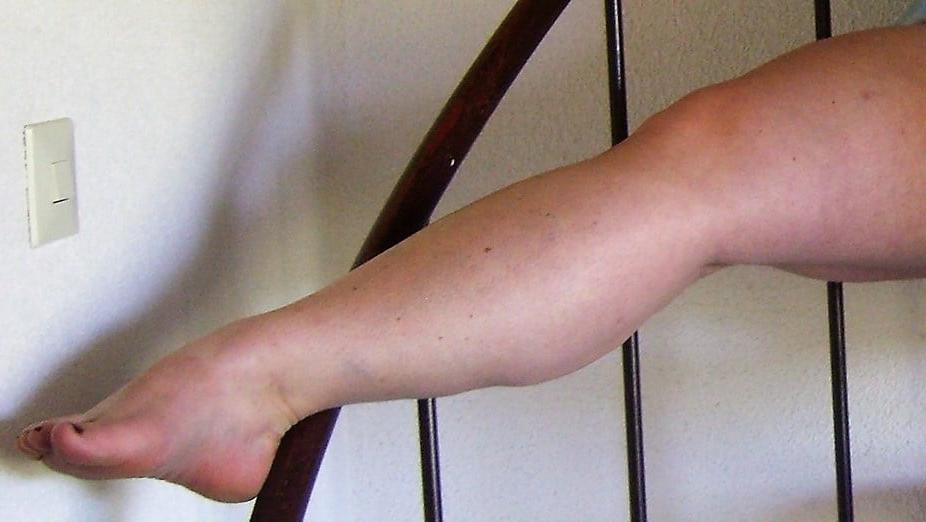 25P Sexy &amp; Chubby Legs 10