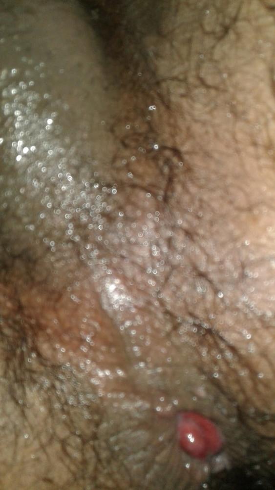 7P My ass hole