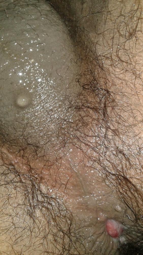7P My ass hole