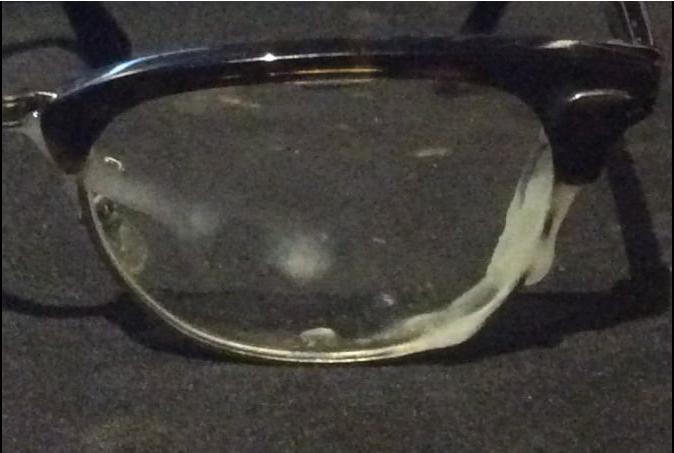 24P GLASSES !