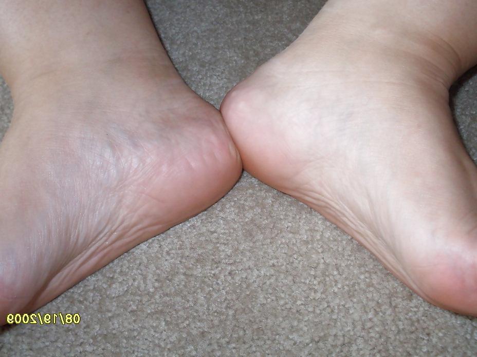 23P Feet & Sexitoes