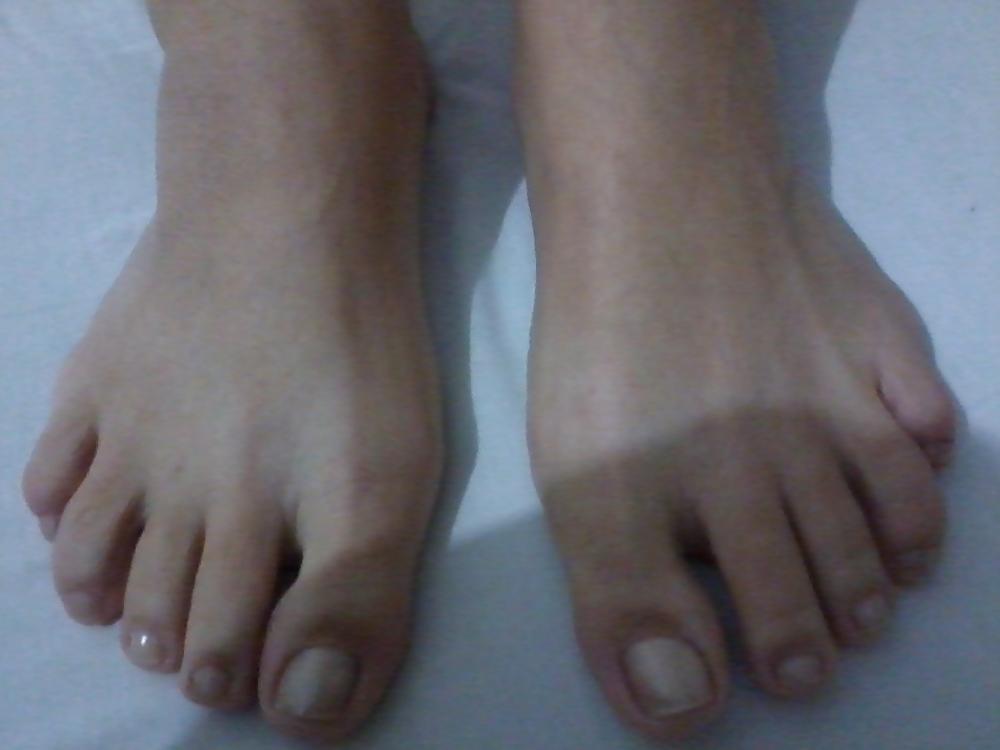 17P Prostitutes feet