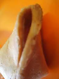 17P The art of vaginal beauty