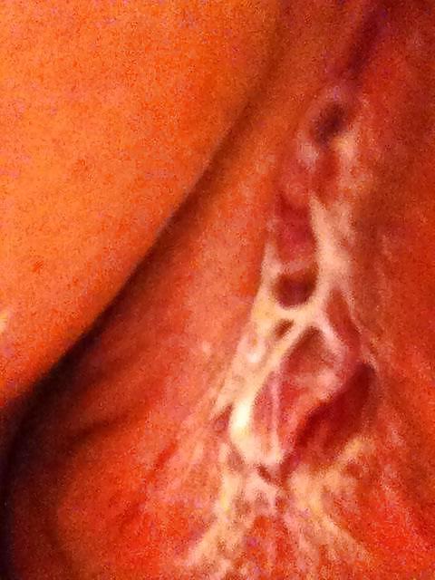 25P BBW's for BBC