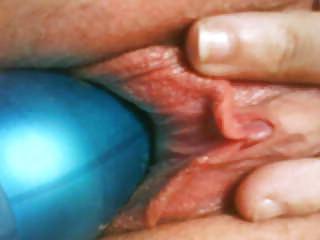 5P My weird insertion