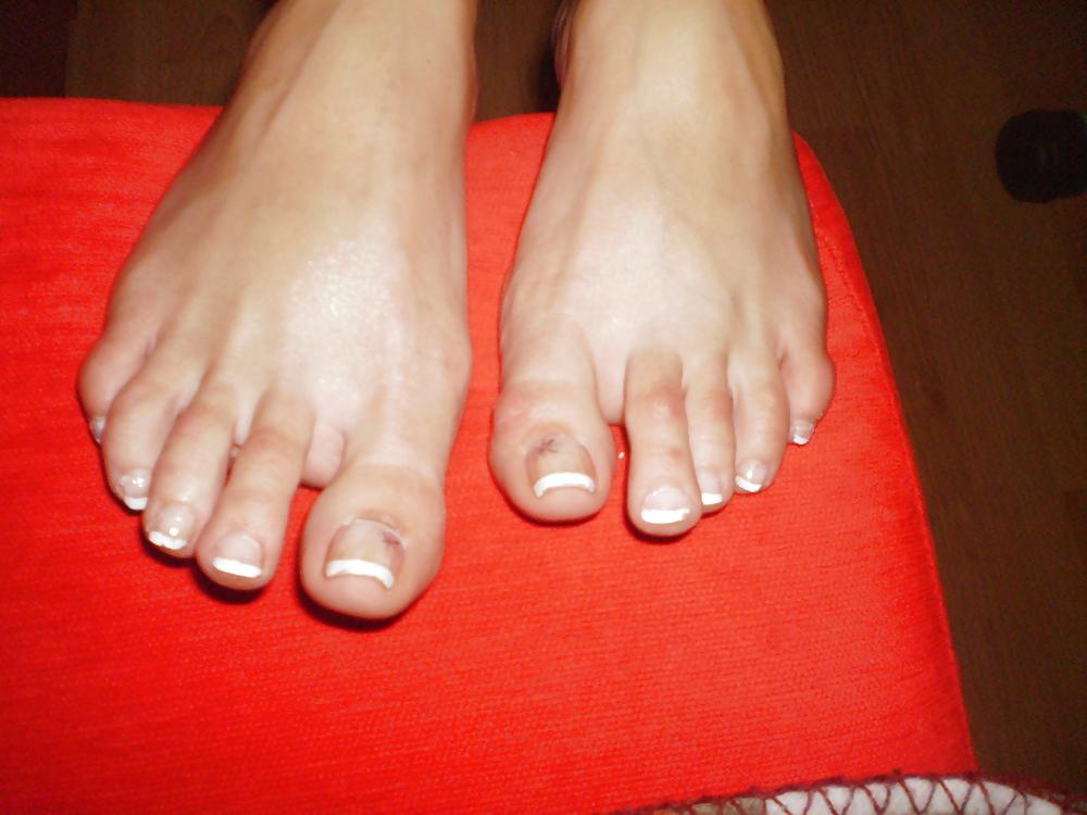 25P Legs feet 