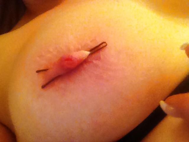22P Tit Play