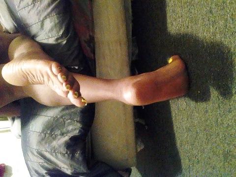 25P ALL TOES