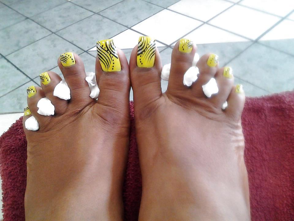 25P ALL TOES