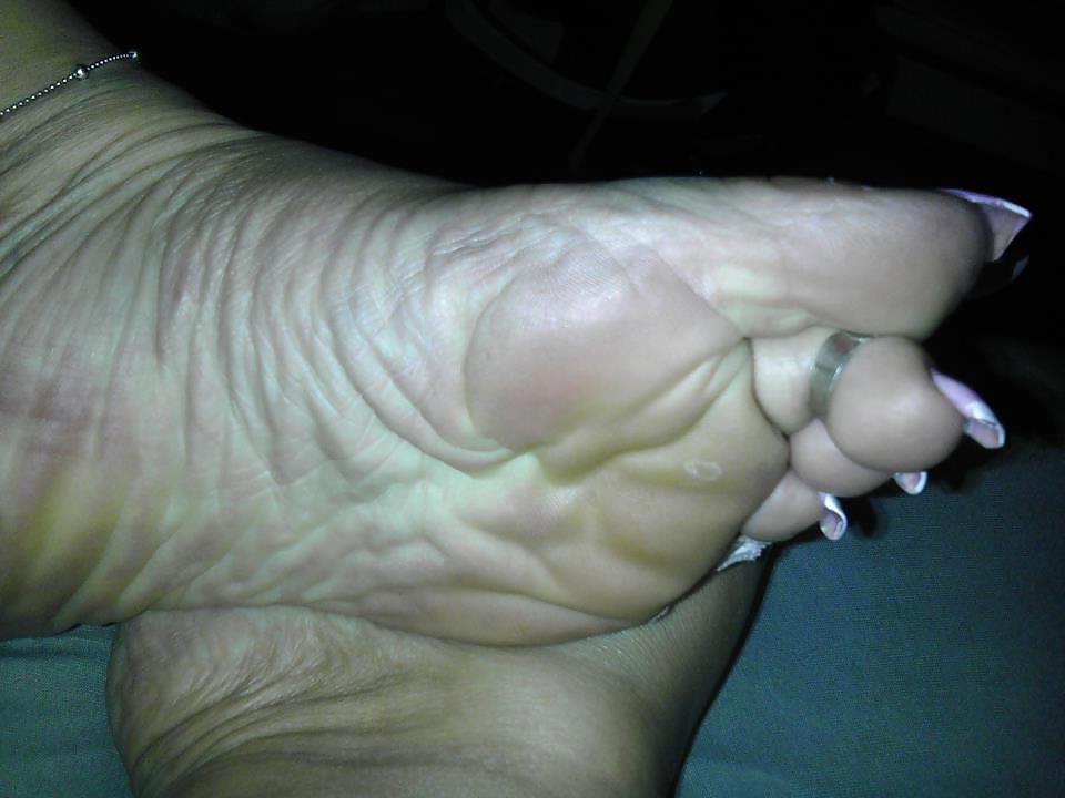 25P ALL TOES