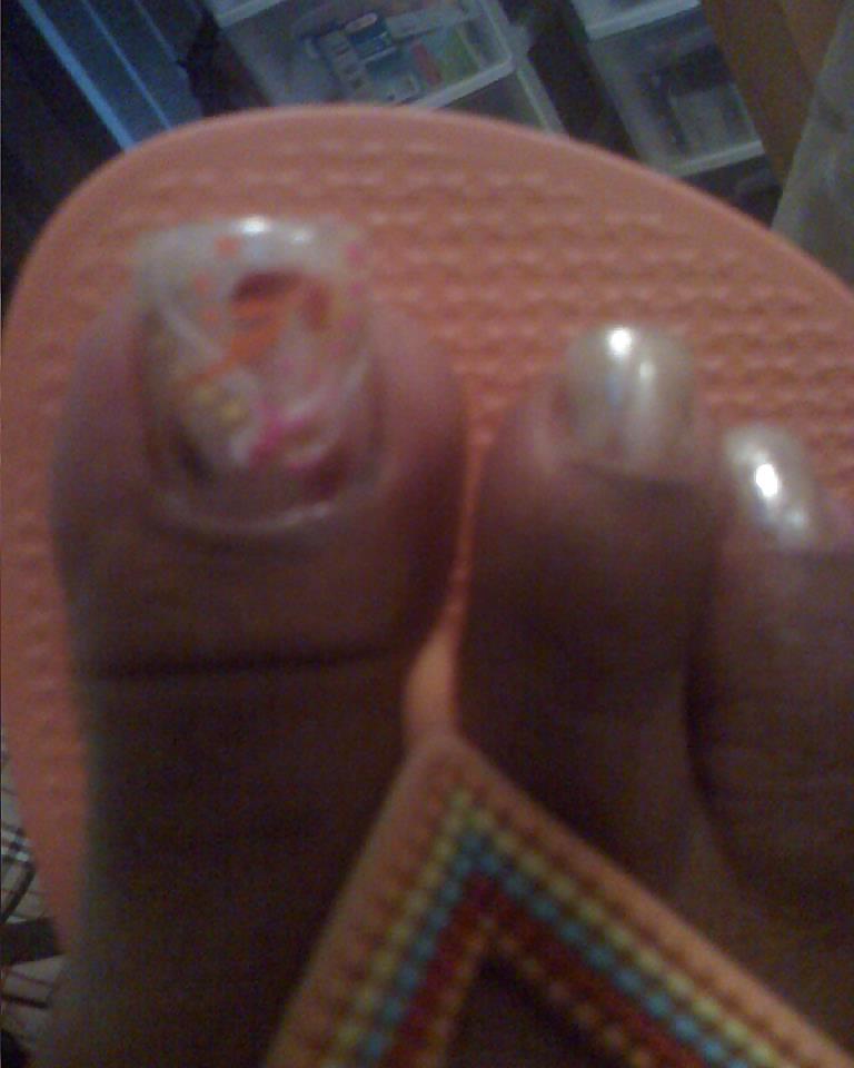 25P ALL TOES
