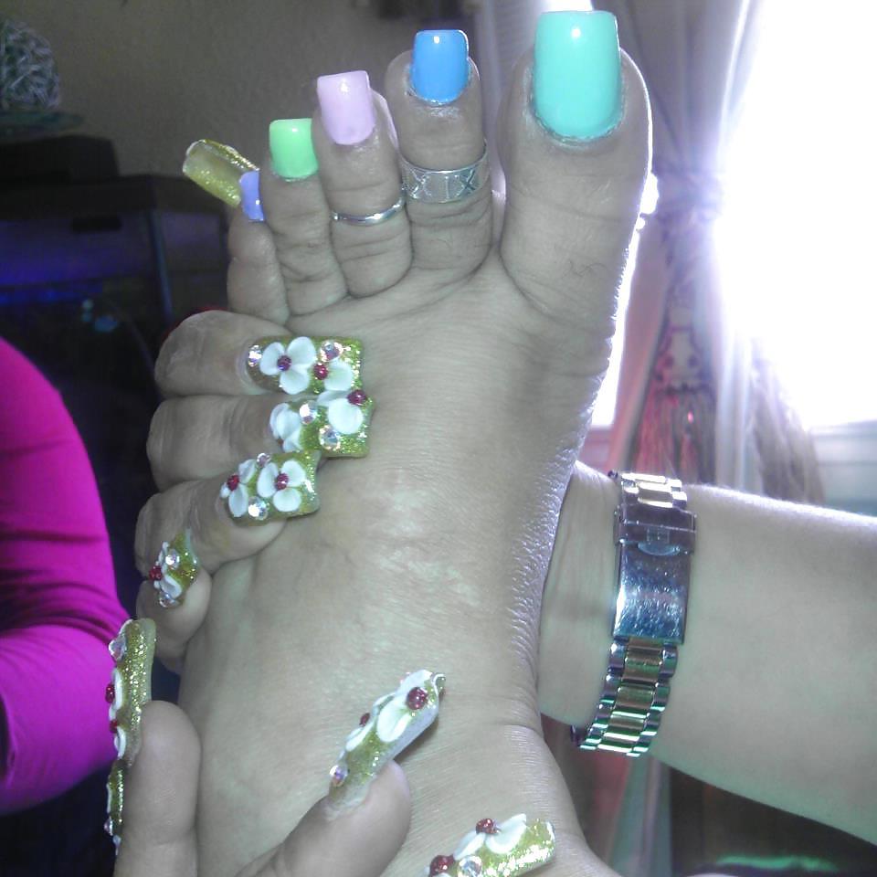25P ALL TOES