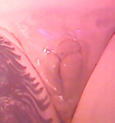 25P Sissy clit bitch's newest pics