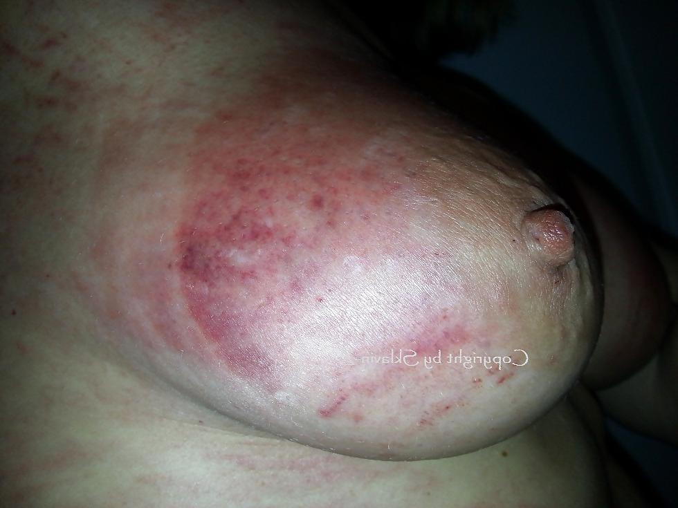 5P Again a new tit torture