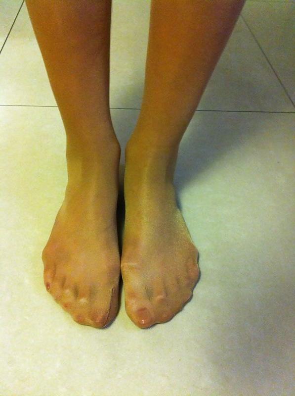 24P Pantyhose toes