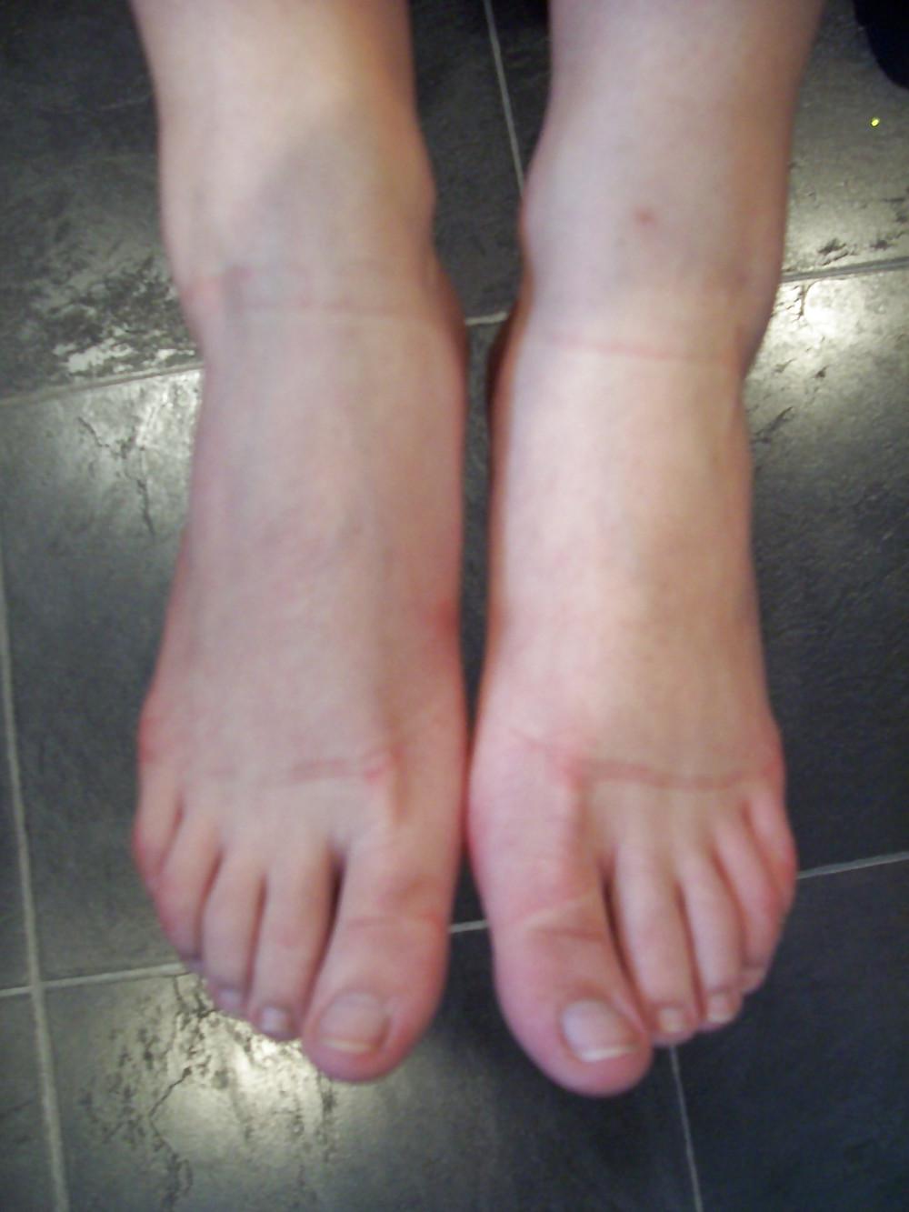 25P Honey B lapdancer feet and more