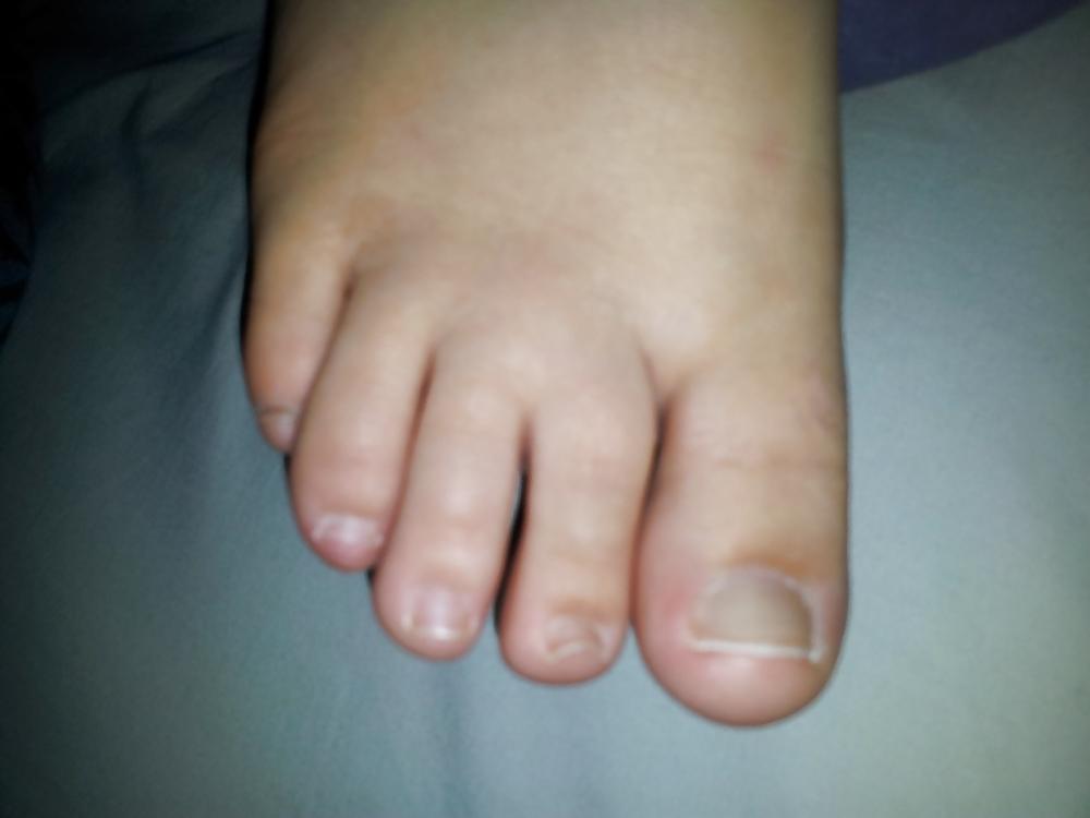 23P Ten Teeny Tiny Tantilizing Toes