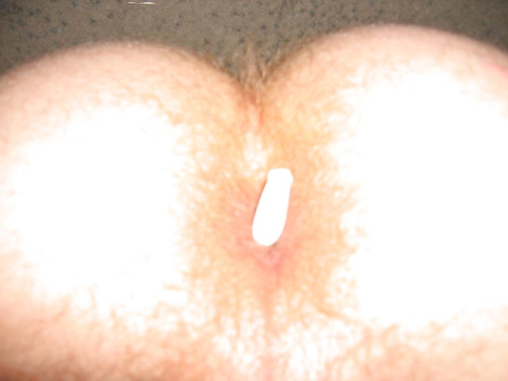 24P Rectal temp and suppository