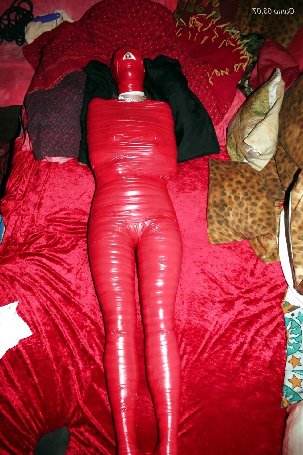 20P Tape mummification