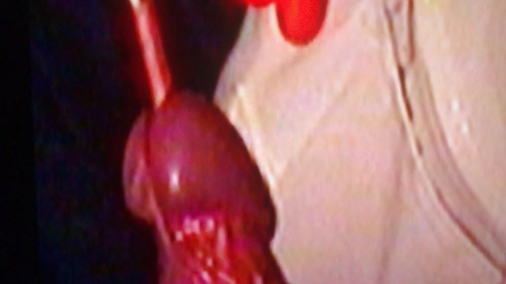 10P Cigarette in cock