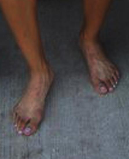 4P Female Track Athletes feet.