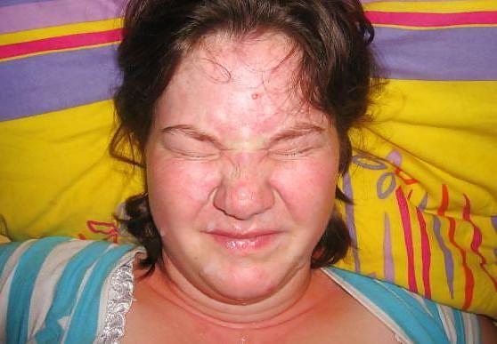 25P Chubby facials
