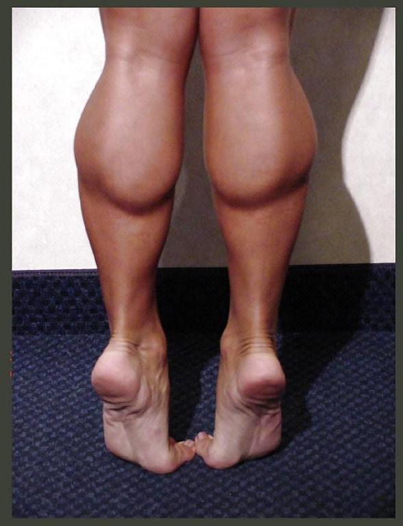 25P FBB arch feet and leg gallery