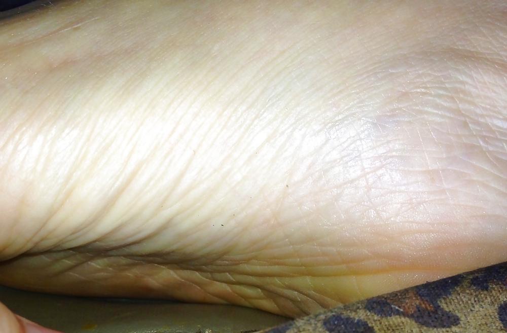 25P 9 west and my feet