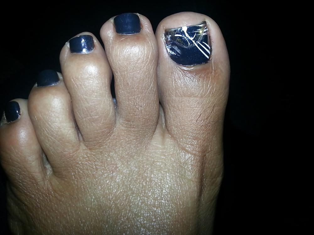 22P Amateur feet and toes