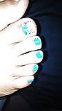22P Amateur feet and toes