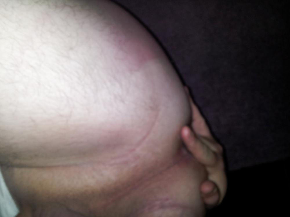 4P First prostate play