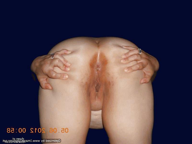 22P Areola queen
