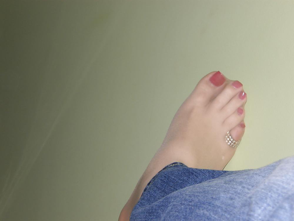 25P Nylon Feet