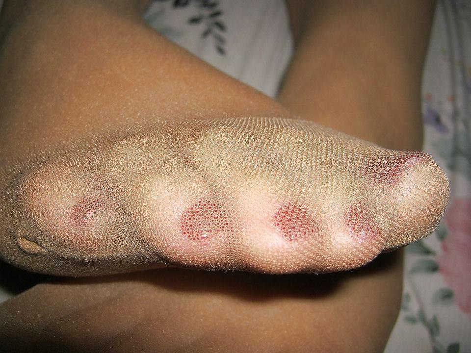 24P Stocking Toes