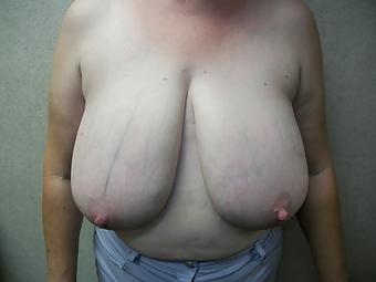 16P Huge natural amateur tits 4