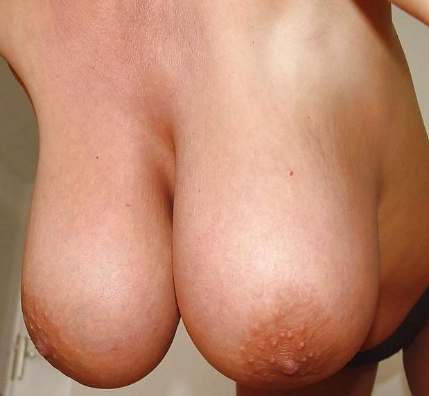 25P Mature chunky tits