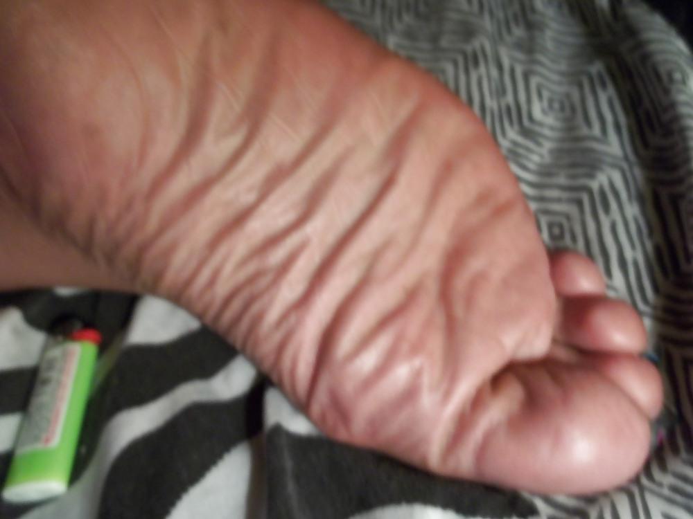 17P ALL ABOUT THE FEET AND TOES...